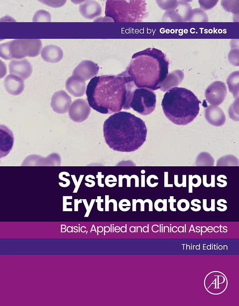 Systemic Lupus Erythematosus: Basic, Applied and Clinical Aspects 3rd Edition