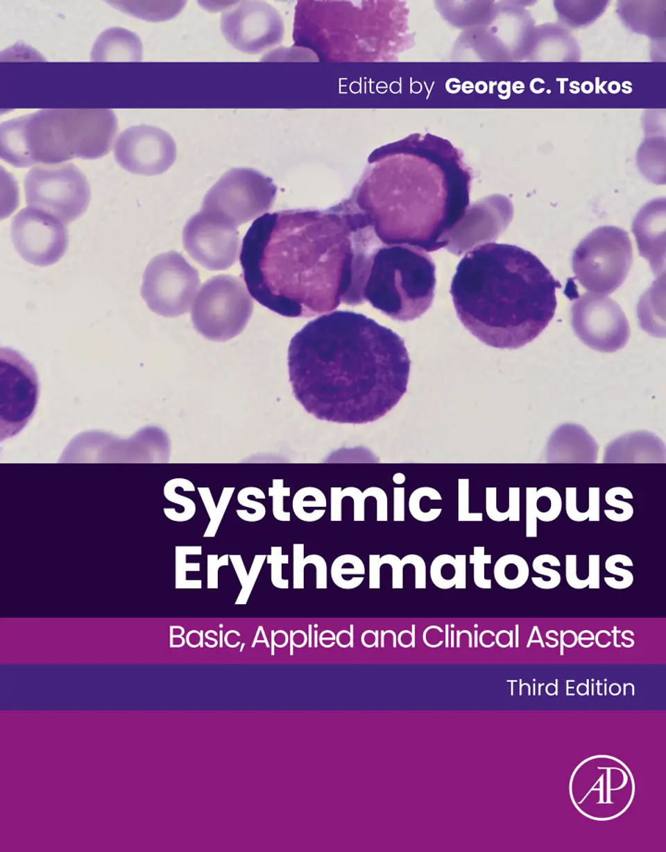 Systemic Lupus Erythematosus: Basic, Applied and Clinical Aspects 3rd Edition 1