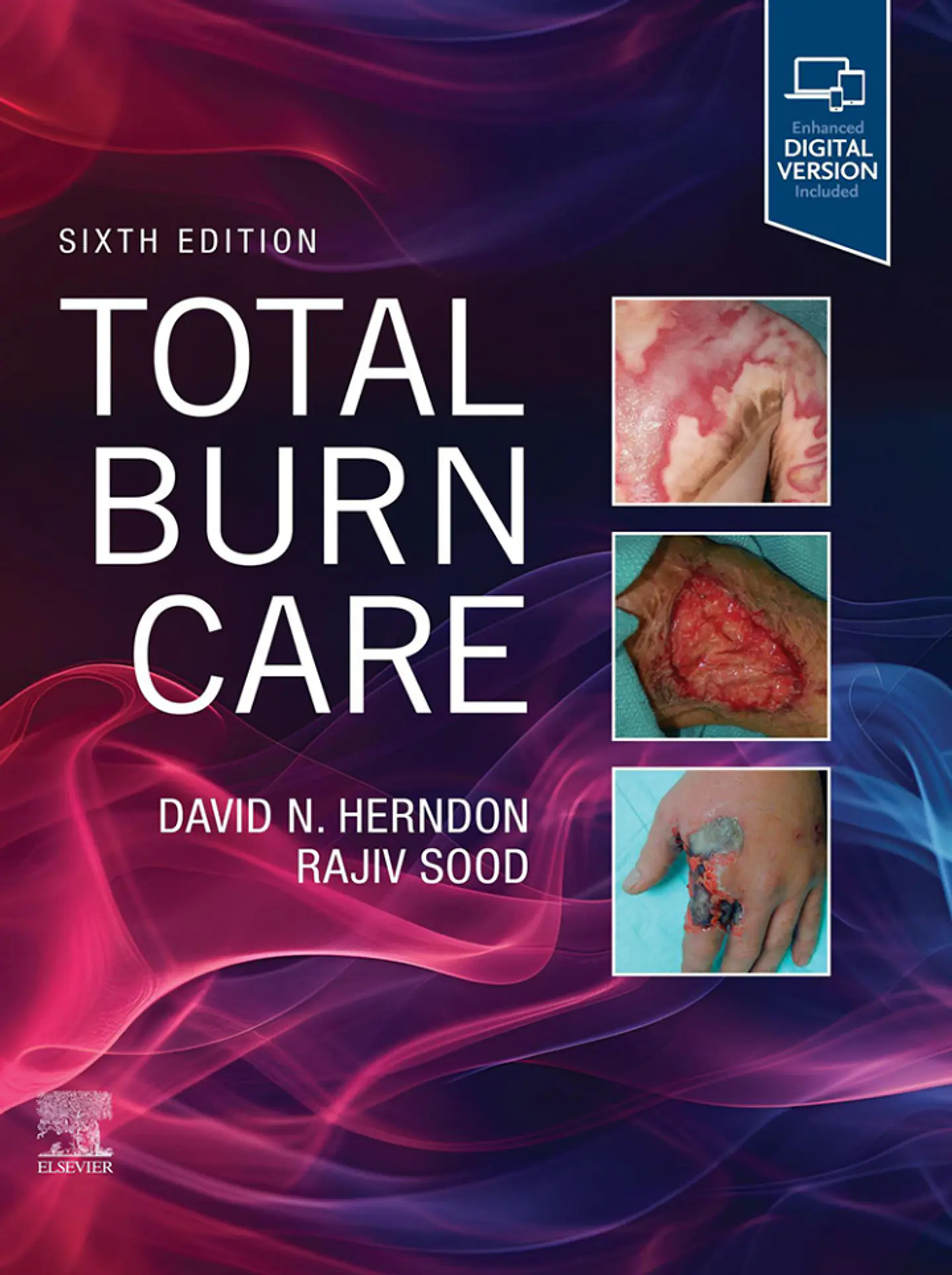 Total Burn Care 6th Edition 1