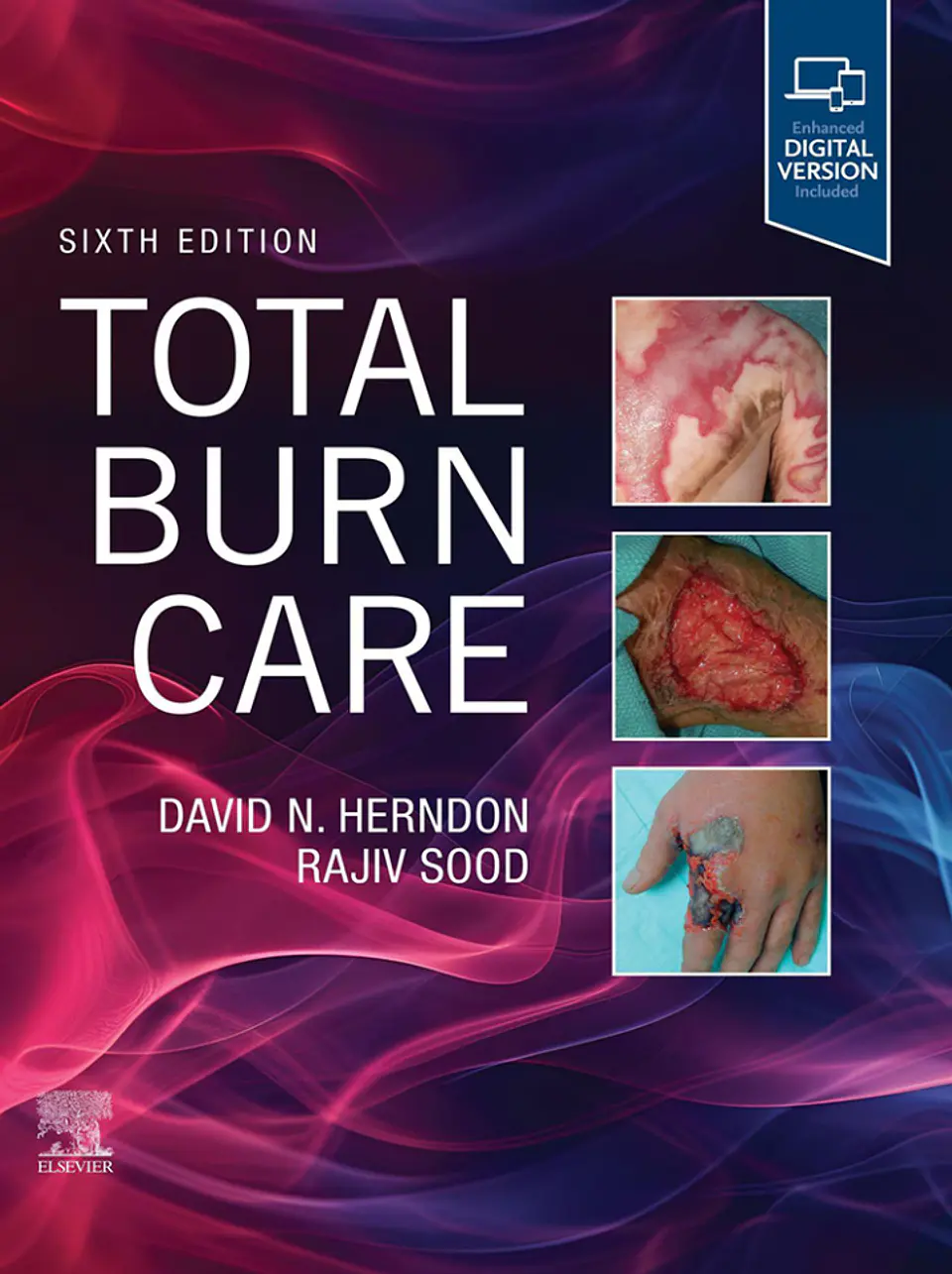 Total Burn Care 6th Edition 1