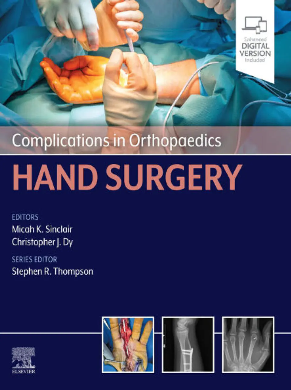 Complications in Orthopaedics: Hand Surgery 1