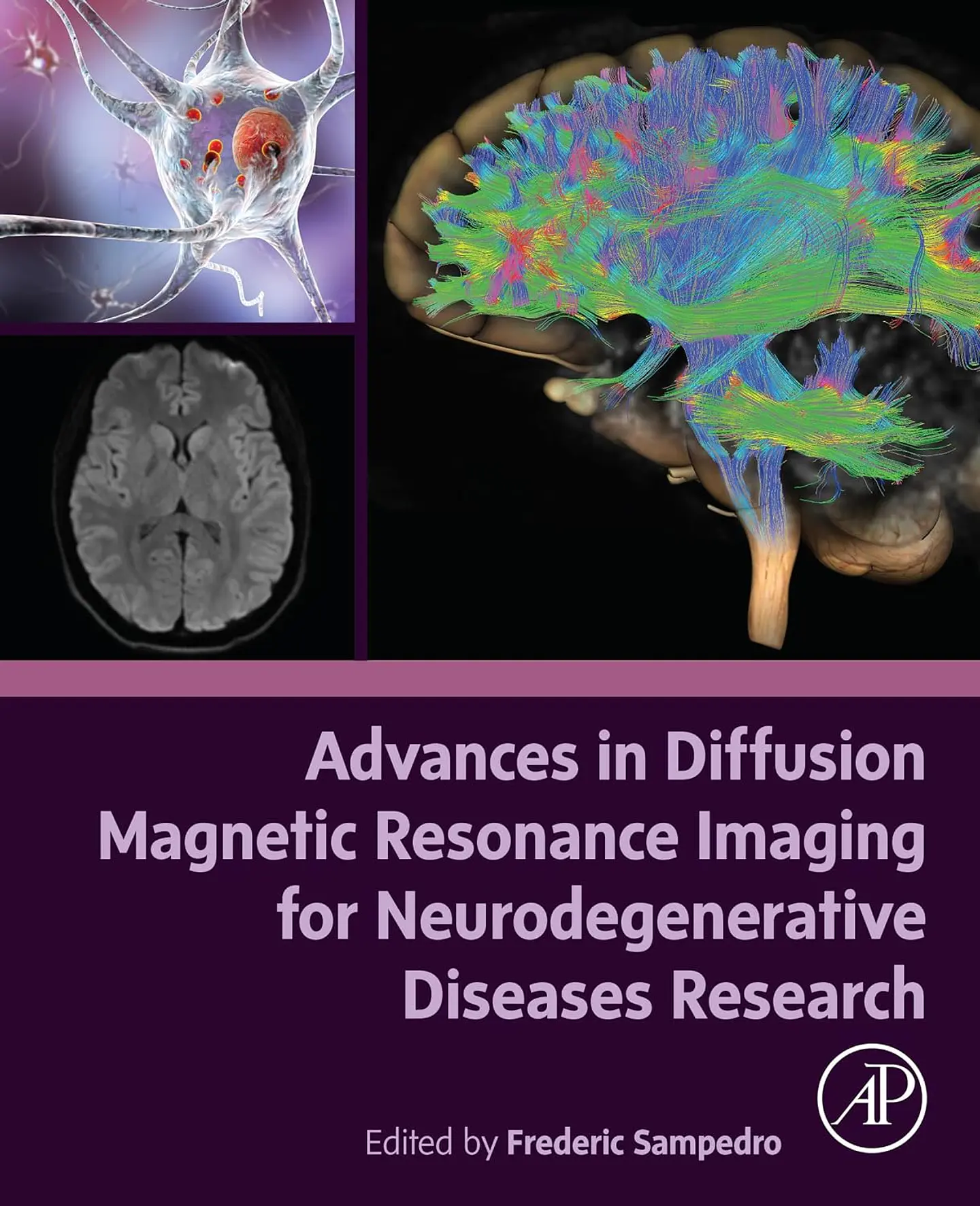 Advances in Diffusion Magnetic Resonance Imaging for Neurodegenerative Diseases Research 1