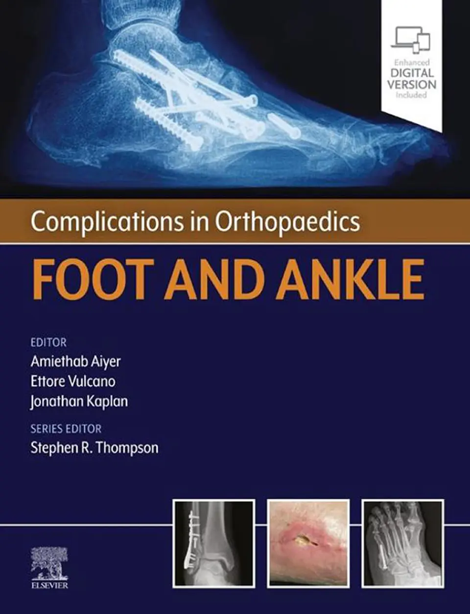  Complications in Orthopaedics Series Foot and Ankle  1
