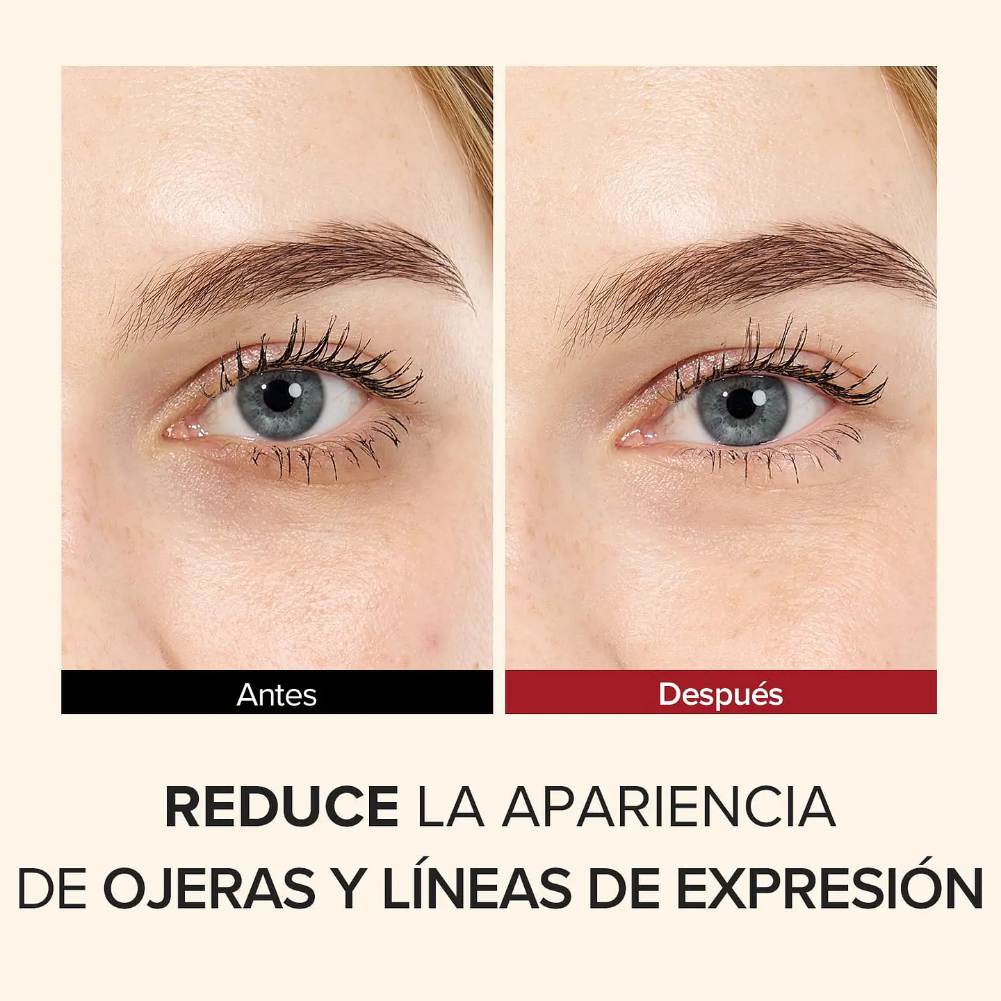 Creme para olhos com ácido tranexâmico  3
