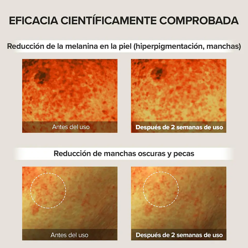 Creme para olhos com ácido tranexâmico  7