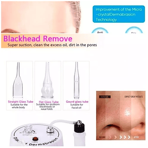 Microdermoabracion Profesional Punta De Diamante