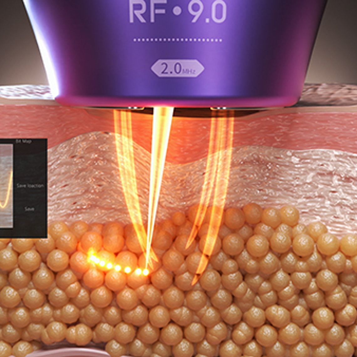 Reductor de grasa corporal HIFU 4