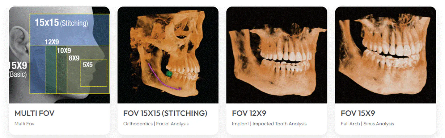 ORTO CBCT OSSTEM T2-CS 3