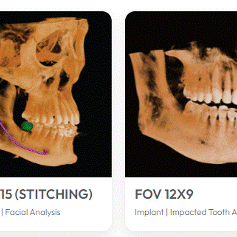 ORTO CBCT OSSTEM T2-CS 3