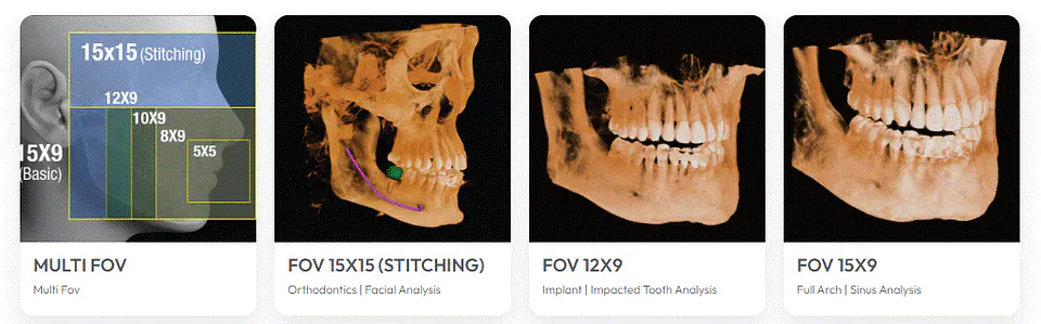 ORTO CBCT OSSTEM T2-CS 3