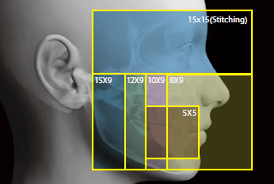 ORTO CBCT OSSTEM T2-CS 5