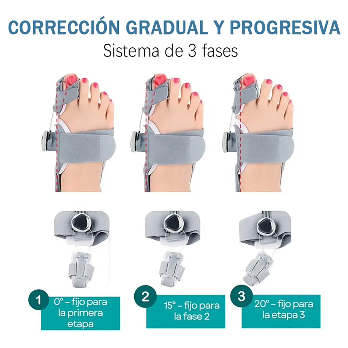 Corrector De Juanetes Ferula Perilla Ajustable Ortopedica 5