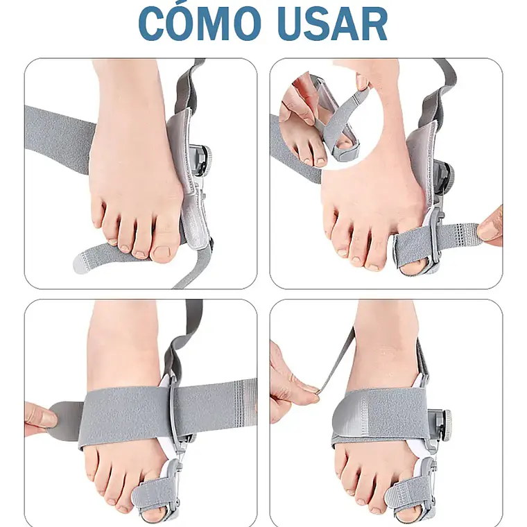 Corrector De Juanetes Ferula Perilla Ajustable Ortopedica 7