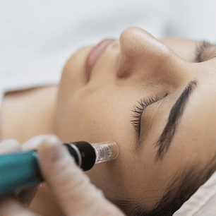 Carboxiterapia Topica