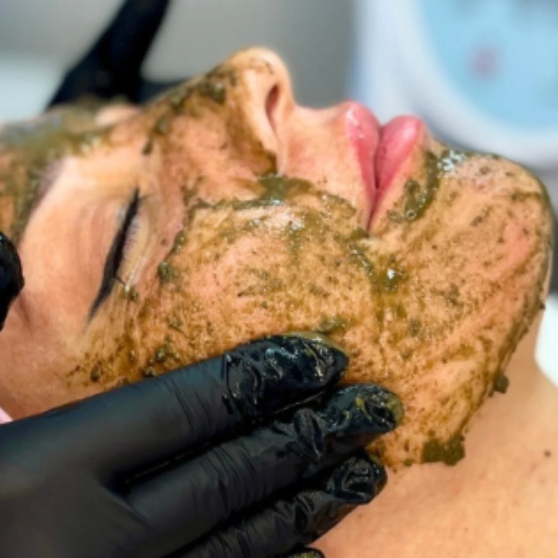 Peeling de Algas Zena (3 sesiones) 1