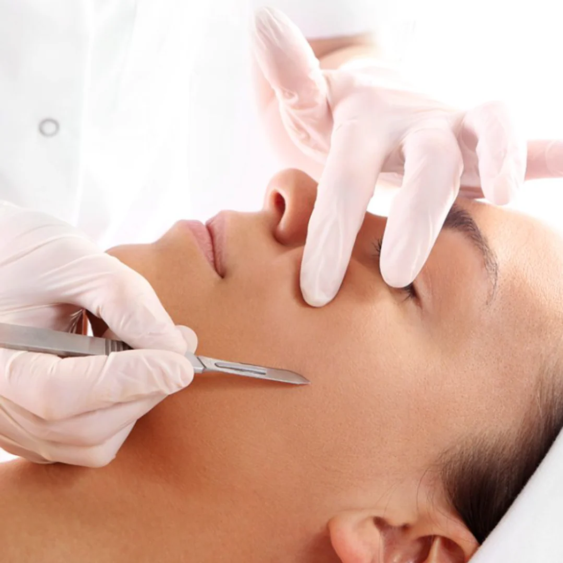 Dermaplaning + Limpieza Facial Profunda 1