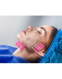 Hilos revitalizantes