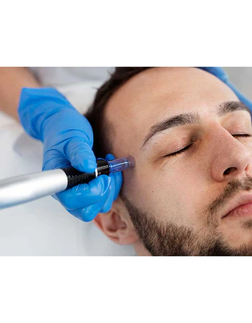 Vitaminas faciales (Dermapen)