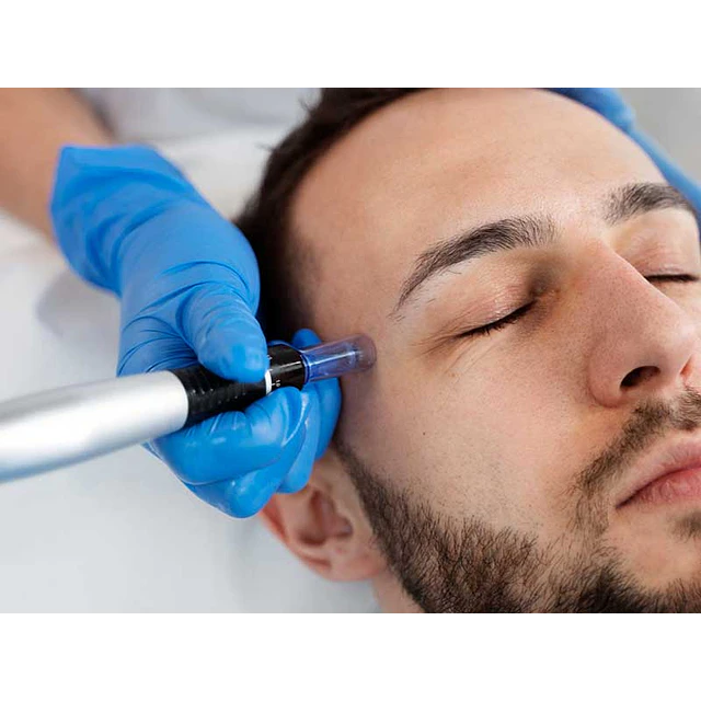 Vitaminas faciales (Dermapen)
