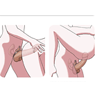 VIBRADOR DOBLE PLACER 3