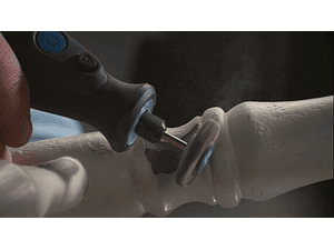 Disco de lixa em lamelas, de 4,8 mm (504) DREMEL 