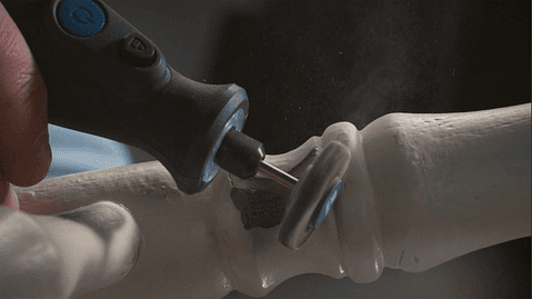 Disco de lixa em lamelas, de 4,8 mm (504) DREMEL 