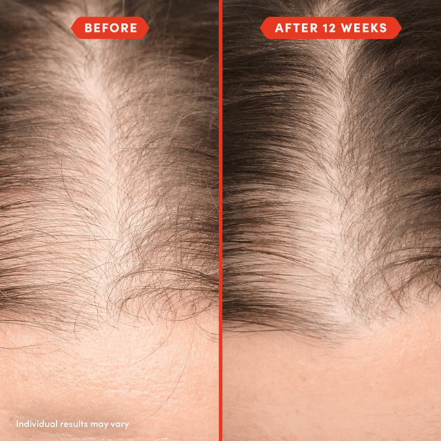 HoliRoots™ Pre-Wash Scalp & Hair Treatment Oil