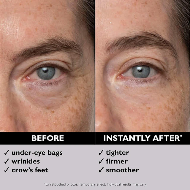 Instant FIRMx® Eye Temporary Eye Tightener