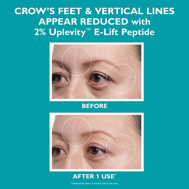 Peptide Skinjection™ Hydra-Gel Face and Eye Mask Patches for Expression Lines