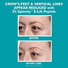 Peptide Skinjection™ Hydra-Gel Face and Eye Mask Patches for Expression Lines