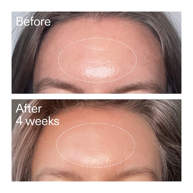 Advanced Retinal Serum for Fine lines + Wrinkles