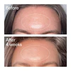Advanced Retinal Serum for Fine lines + Wrinkles