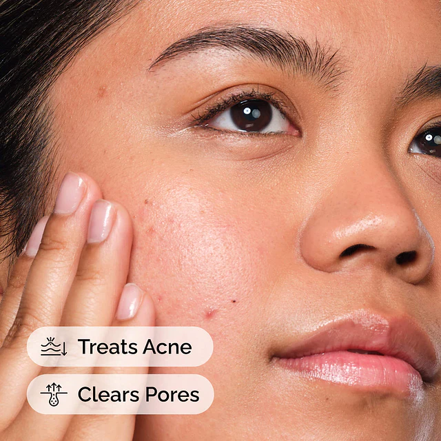 Salicylic Acid 2% Solution, Exfoliating Serum for Acne