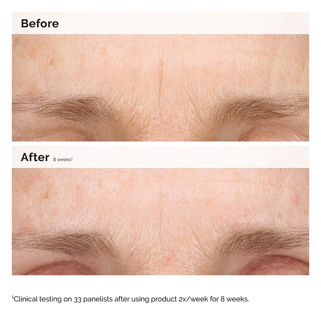 Retinal 0.2% Emulsion High-Strength Retinoid Nighttime Treatment