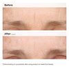 Retinal 0.2% Emulsion High-Strength Retinoid Nighttime Treatment