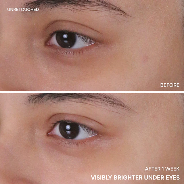 Vitamin C Niacinamide Brightening Eye Serum for Dark Circles