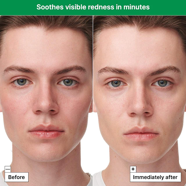 Cicapair ™ Sensitive Skin Serum Face Mask for Redness