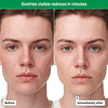 Cicapair ™ Sensitive Skin Serum Face Mask for Redness