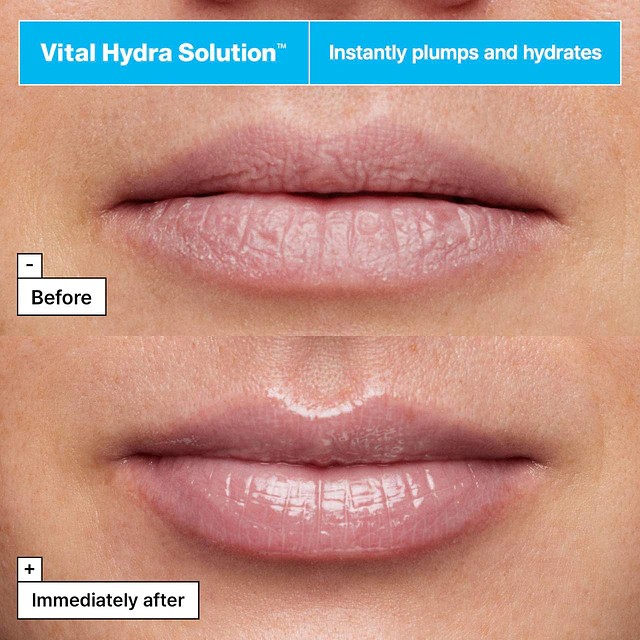Vital Hydra Solution™ Jelly Bear Lip Mask with Hyaluronic Acid