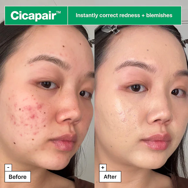 Cicapair™ Soothing Color Correcting Treatment SPF 30 with Centella Asiatica Extracts