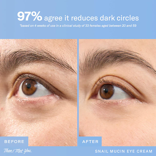 Snail Mucin Firming and Brightening Korean Eye Cream