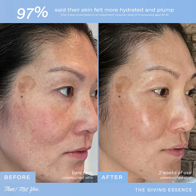 The Giving Essence Brightening & Hydrating Korean Treatment 