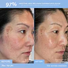 The Giving Essence Brightening & Hydrating Korean Treatment 