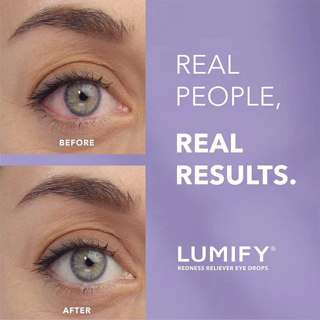 Lumify Eye Drops for Redness Relief