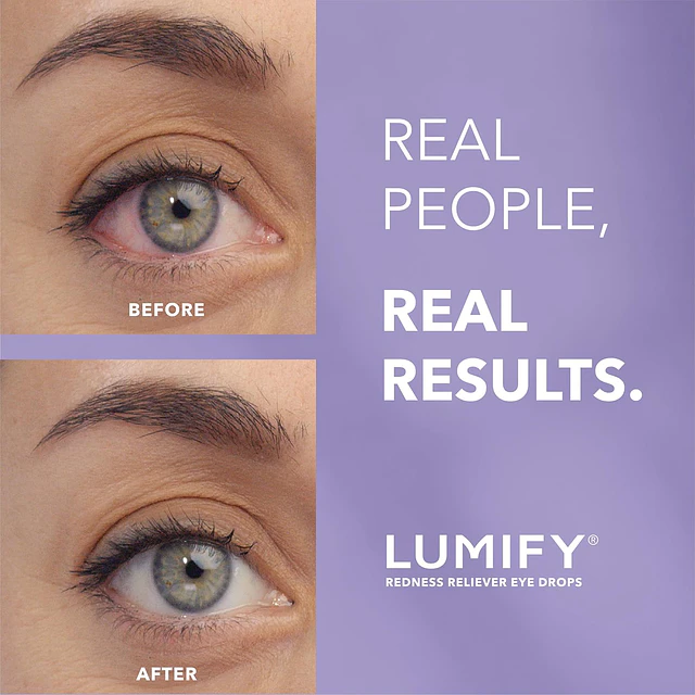 Lumify Eye Drops for Redness Relief