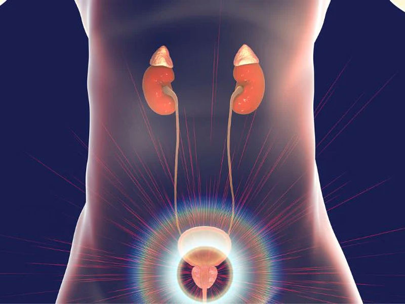 El Cáncer de Próstata: Síntomas y Opciones de Tratamiento