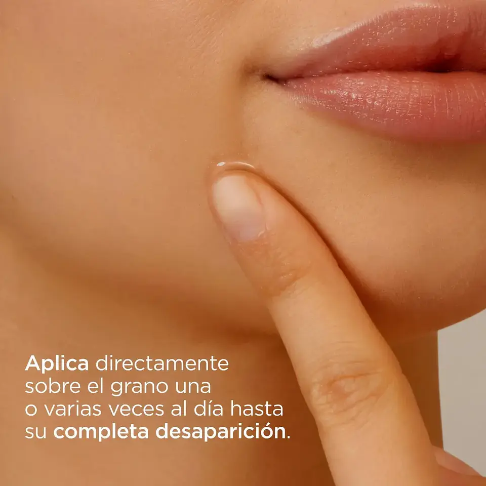 Corrector De Granos Faciales Localizados Piel Grasa 15ml Acniben 4