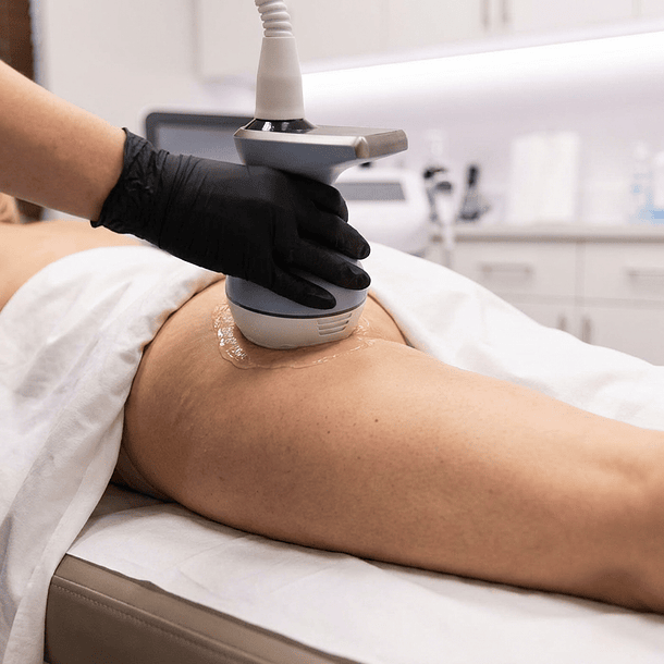 EXION Corporal Zona Pequeña – Pack 8 sesiones