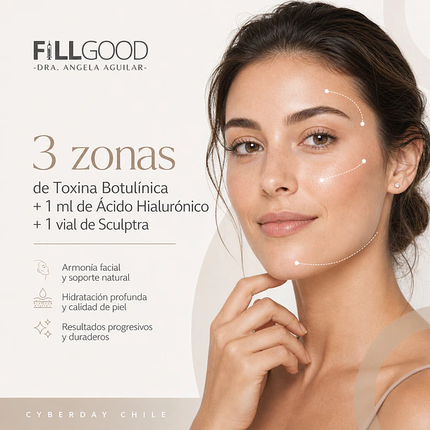 Toxina Botulínica 3 zonas + 1 ml Acido Hialurónico + 1 Sculptra