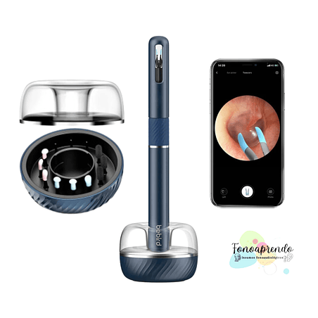 Otoscopio Bebird Note 5 Pro 1